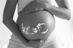 妊娠线看胎儿性别